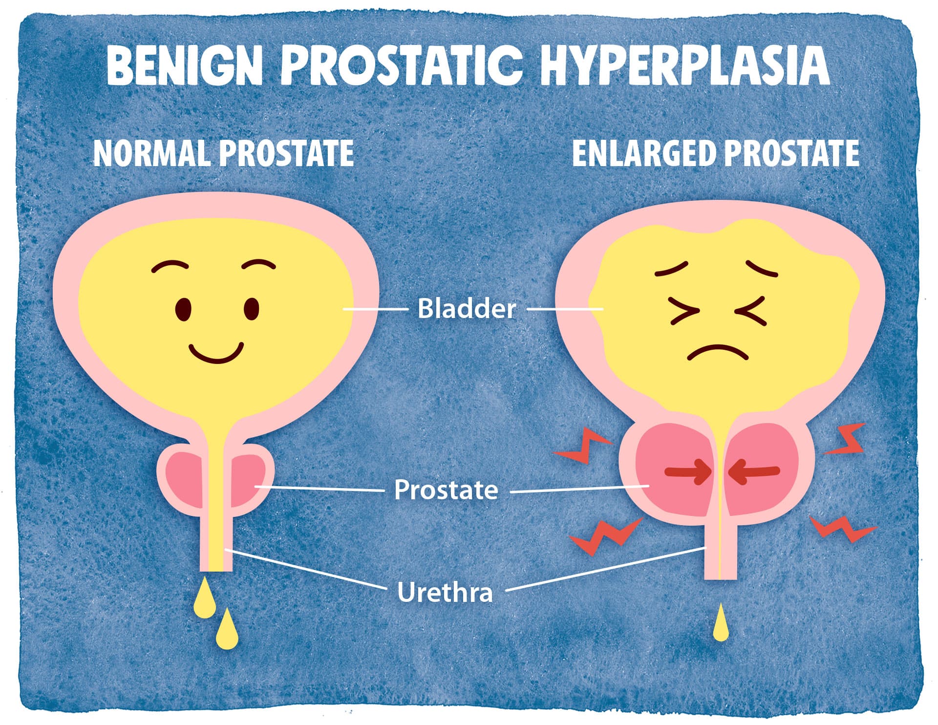 See the difference? Read on to learn about the solution
